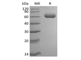 Recombinant Mouse Siglec-F (C-6His)