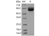 Recombinant Mouse SLC3A2/CD98 Protein (His Tag)