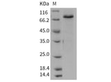 Recombinant Mouse SMAD3 Protein (His & GST Tag) 