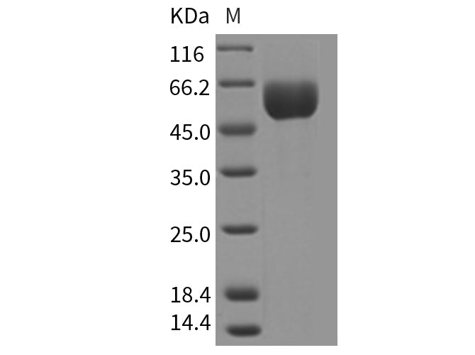 Recombinant Mouse SMPDL3A Protein (His Tag)