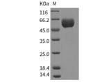 Recombinant Mouse SMPDL3A Protein (His Tag)