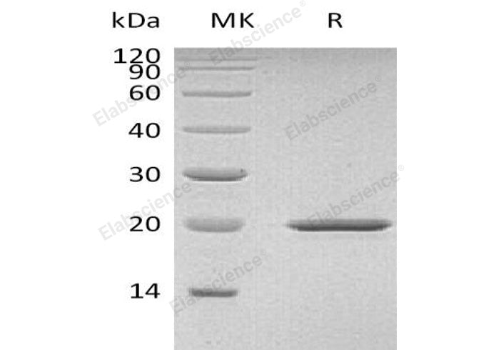 Recombinant Mouse Sonic Hedgehog/SHH Protein (His Tag)(Active)