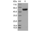 Recombinant Mouse ST6GAL1 Protein (His Tag)(Active)