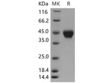 Recombinant Mouse ST6GALNAC2 Protein (His Tag)