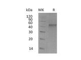 Recombinant Mouse ST6GALNAC2 Protein (His Tag) Purity >95%