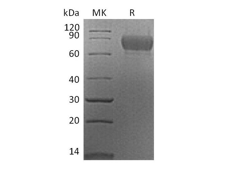Recombinant Mouse SynCam/CADM1 Protein (aa 48-388, His Tag)