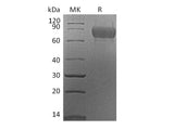 Recombinant Mouse SynCam/CADM1 Protein (aa 48-388, His Tag)