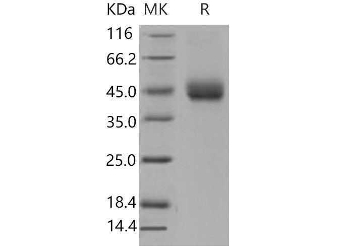 Recombinant Mouse TFPI Protein (His Tag)(Active)