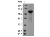 Recombinant Mouse TFPI2 Protein (Fc Tag)
