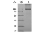 Recombinant Mouse TGFBR3 (C-6His)