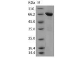 Recombinant Mouse Tie2/CD202b Protein (aa 770-1122, His & GST Tag)(Active)