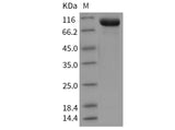 Recombinant Mouse Tie2/CD202b Protein (His Tag)(Active)