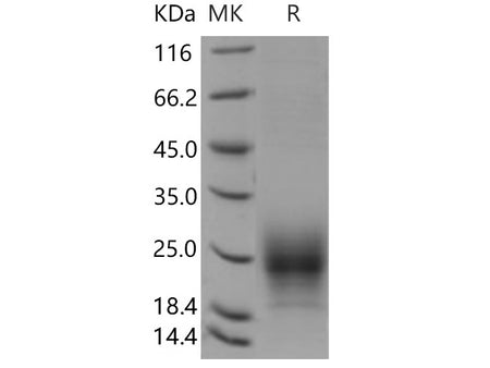 Recombinant Mouse TIGIT Protein (His Tag)(Active)