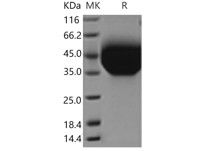 Recombinant Mouse TIM-3/HAVCR2 Protein (aa 1-191, His Tag)