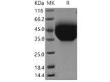 Recombinant Mouse TIM-3/HAVCR2 Protein (aa 1-191, His Tag)
