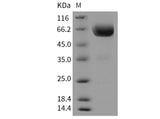Recombinant Mouse TIM-3/HAVCR2 Protein (Fc Tag)