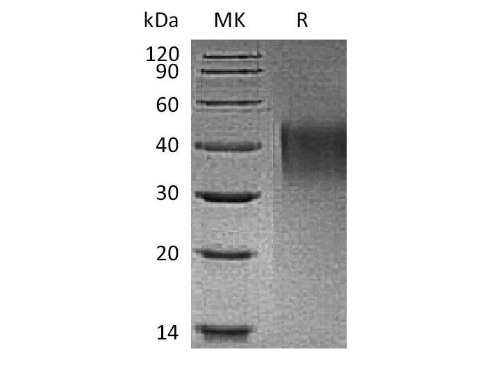Recombinant Mouse TIM1/HAVCR1 Protein (His Tag)