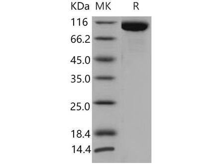 Recombinant Mouse TLR3/CD283 Protein (His Tag)