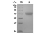 Recombinant Mouse TNF Receptor II/TNF RII/TNFRSF1B/CD120b  (C-6His-Avi) Biotinylated