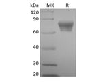 Recombinant Mouse TNF Receptor II/TNF RII/TNFRSF1B/CD120b  (C-Fc)
