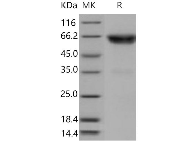 Recombinant Mouse TNFRSF1B/CD120b Protein (Fc Tag) (Active)