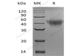 Recombinant Mouse TNFRSF1B/CD120b Protein (His Tag) (Active)