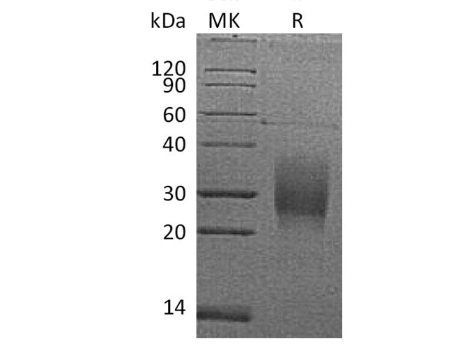 Recombinant Mouse TRAIL R2/TNFRSF10B Protein (AVI & His Tag)