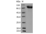 Recombinant Mouse TrkA/NTRK1 Protein (His Tag)(Active)