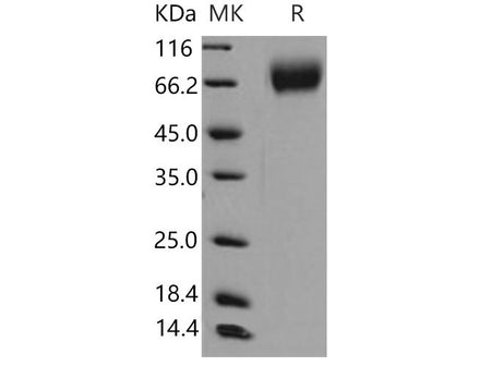 Recombinant Mouse TrkB/NTRK2 Protein (His Tag)(Active)