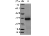 Recombinant Mouse TWSG1/TSG Protein (His Tag)