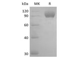 Recombinant Mouse Tyrosine-protein kinase receptor UFO/AXL oncogene/UFO (C-FC)