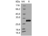 Recombinant Mouse UCHL3/UCH-L3 Protein (His Tag)(Active)