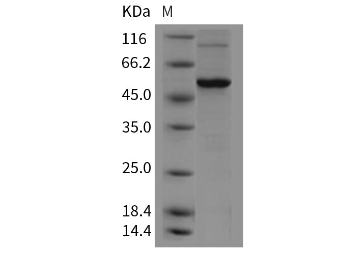 Recombinant Mouse VDR/NR1I1 Protein (His Tag)