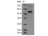 Recombinant Mouse VDR/NR1I1 Protein (His Tag)