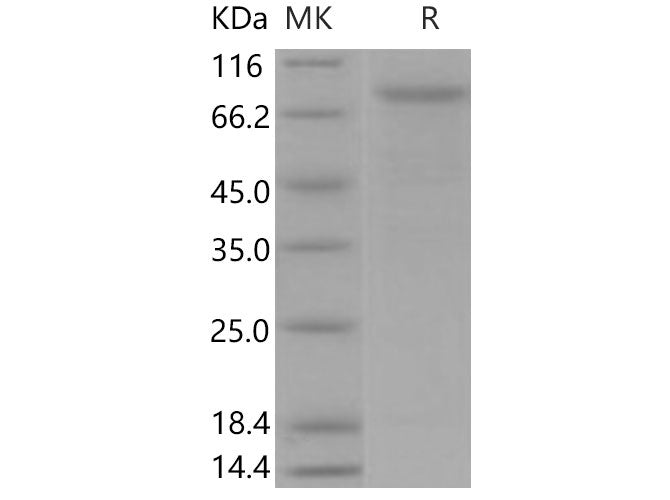 Recombinant Mouse VE-Cadherin/CDH5 Protein (His Tag)