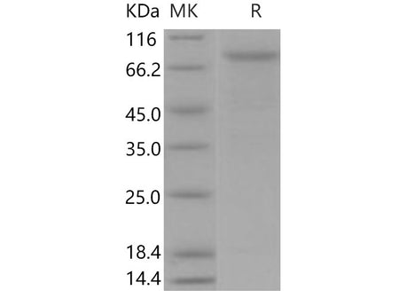 Recombinant Mouse VE-Cadherin/CDH5 Protein (His Tag)