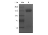 Recombinant Mouse VEGF Receptor 2/VEGF R2/FLK-1/KDR (C-Fc)