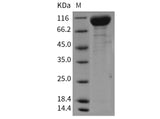 Recombinant Mouse VEGFR2/Flk-1/KDR Protein (His Tag)