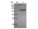 Recombinant Mouse YM1/ECF-L/Chil3 Protein (Pro105Ser)(His Tag)
