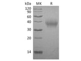 Recombinant Rabbit B7-1/CD80 Protein (His Tag)