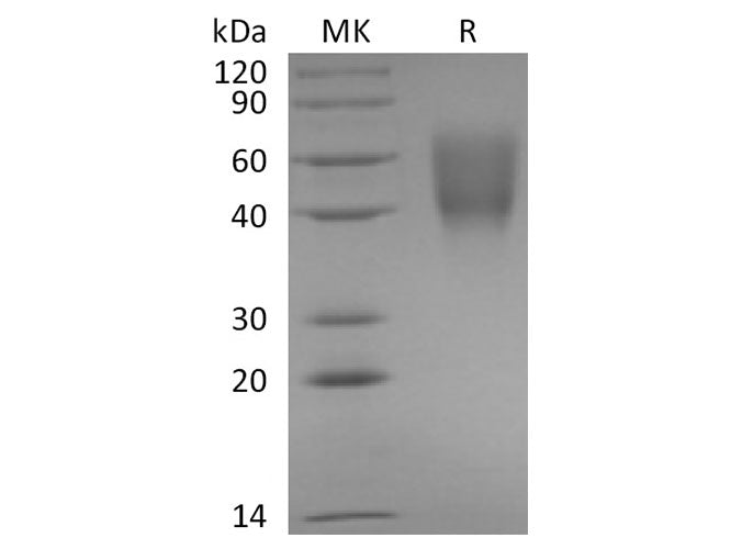 Recombinant Rabbit B7-2/CD86 Protein (His Tag)