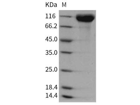 Recombinant Rat ACE2 Protein (His Tag)(Active)