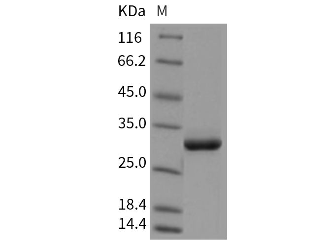 Recombinant Rat APCS/SAP Protein (His Tag)
