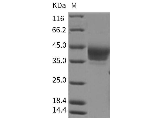 Recombinant Rat B7-H6/NCR3LG1 Protein (His Tag)