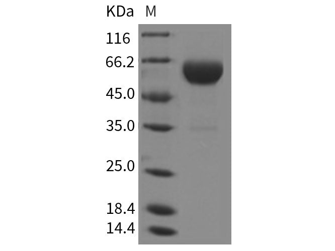 Recombinant Rat Carboxypeptidase B2/CPB2 Protein (His Tag)