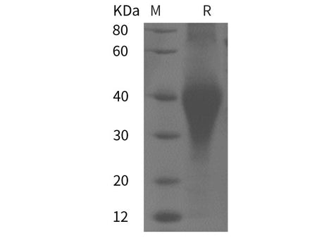 Recombinant Rat CCl2 protein (His tag)