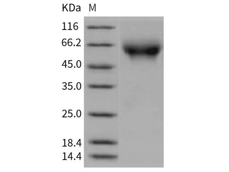 Recombinant Rat CD155/PVR/NECL5 Protein (His Tag)(Active)