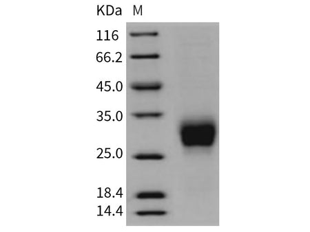 Recombinant Rat CD16a/FCGR3A Protein (His Tag)(Active)