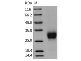 Recombinant Rat CD16a/FCGR3A Protein (His Tag)(Active)