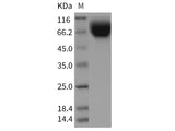 Recombinant Rat CD172a/SIRPA Protein (His Tag)(Active)